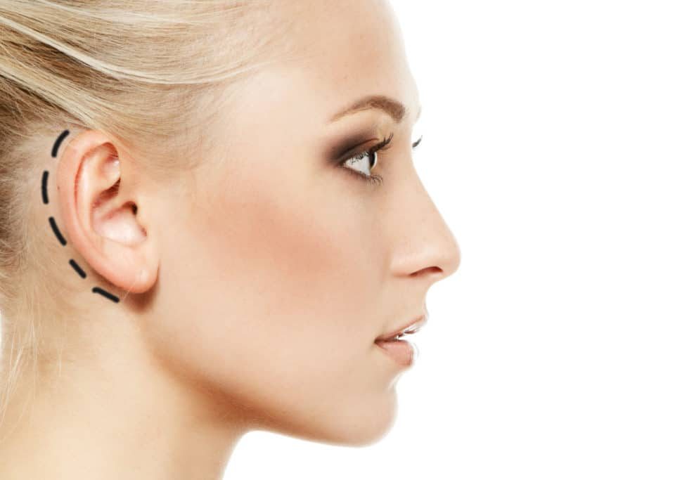مضاعفات عملية تجميل الأذن البارزة