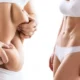 عمليات شفط الدهون