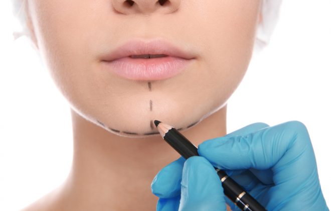 Chin Surgery ( Mentoplasty )