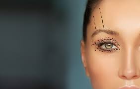Eyelid Surgery ( Blepharoplasty )