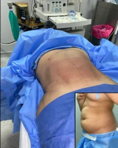 أفضل دكتور نحت جسم في مصر