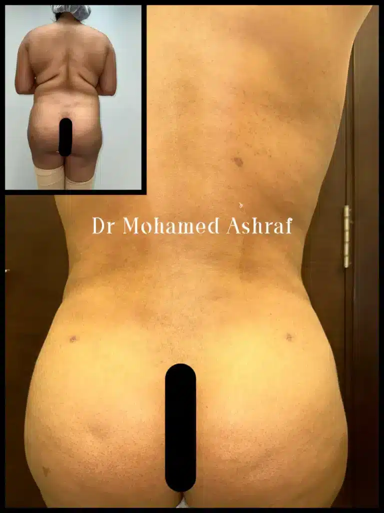 نحت الظهر و الخصر و تكبير المؤخره