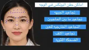 حقن بوتوكس الوجه
