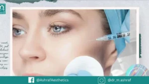 أسعار حقن الفيلر في مصر ٢٠٢٦